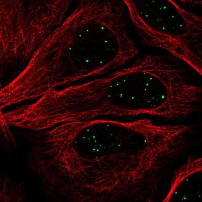 GATA4 Antibody in Immunocytochemistry (ICC/IF)