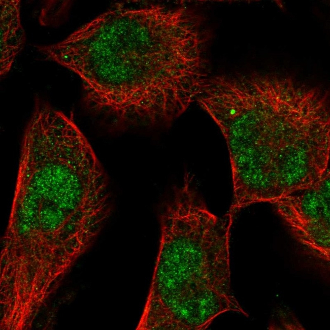 SGK1 Antibody in Immunocytochemistry (ICC/IF)