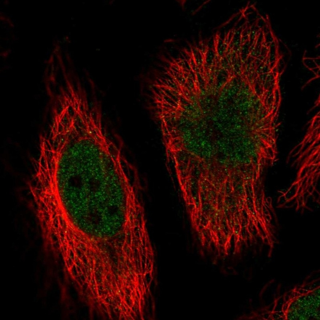ERK5 Antibody in Immunocytochemistry (ICC/IF)