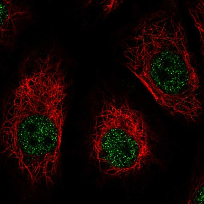 Dynamin 1 Antibody in Immunocytochemistry (ICC/IF)