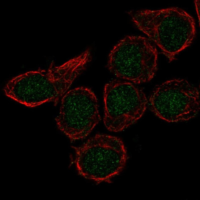 CX3CR1 Antibody in Immunocytochemistry (ICC/IF)