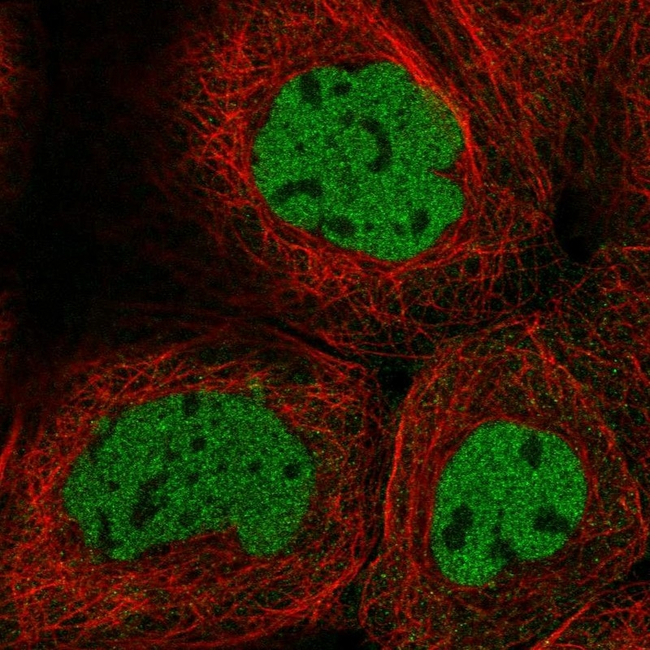 Caspase 2 Antibody in Immunocytochemistry (ICC/IF)