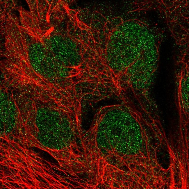 MGMT Antibody in Immunocytochemistry (ICC/IF)