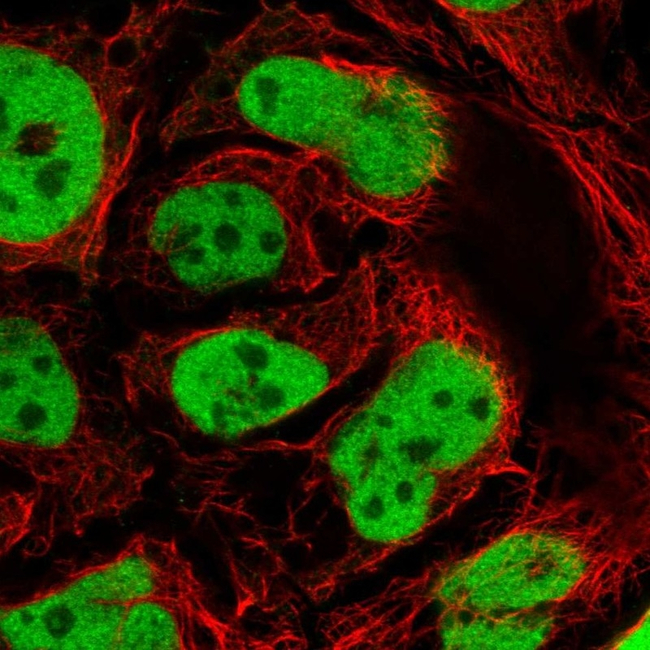 GATA6 Antibody in Immunocytochemistry (ICC/IF)