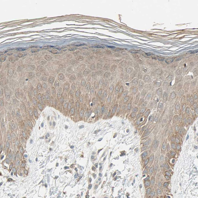 TAK1 Antibody in Immunohistochemistry (Paraffin) (IHC (P))