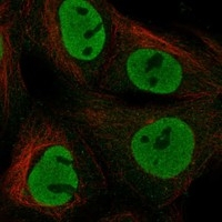 Nanog Antibody in Immunocytochemistry (ICC/IF)