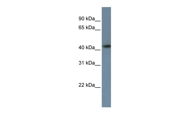 ZNF669 Antibody in Western Blot (WB)