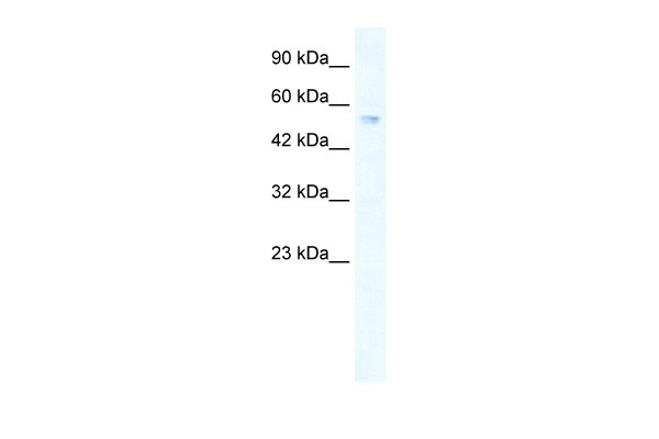 ZNF613 Antibody in Western Blot (WB)