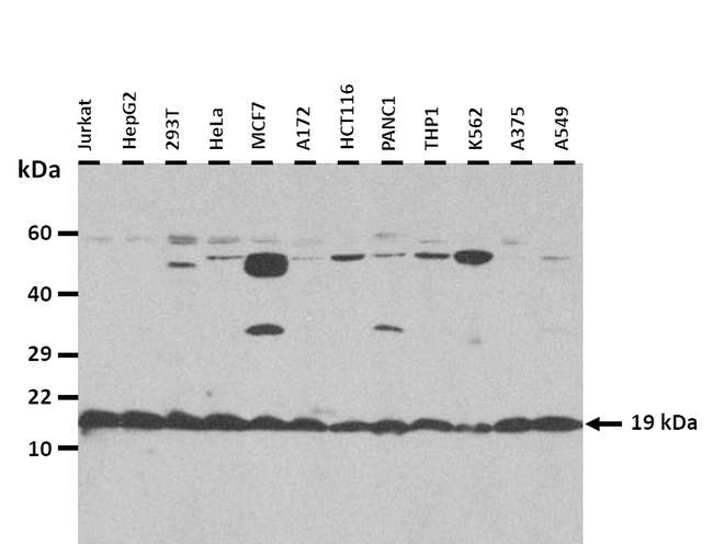 ZNF580 Antibody in Western Blot (WB)