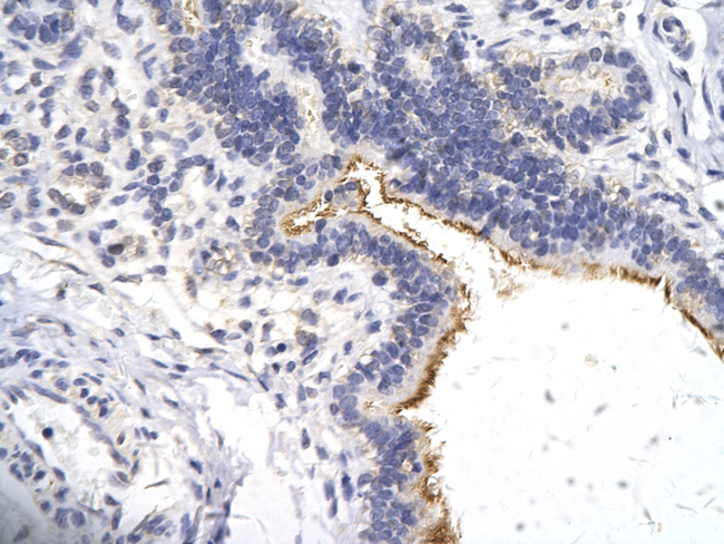 ZNF180 Antibody in Immunohistochemistry (Paraffin) (IHC (P))