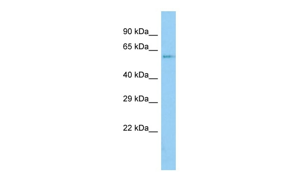 ZNF18 Antibody in Western Blot (WB)