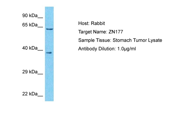 ZNF177 Antibody in Western Blot (WB)