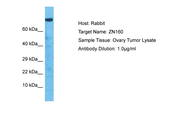 ZNF160 Antibody in Western Blot (WB)