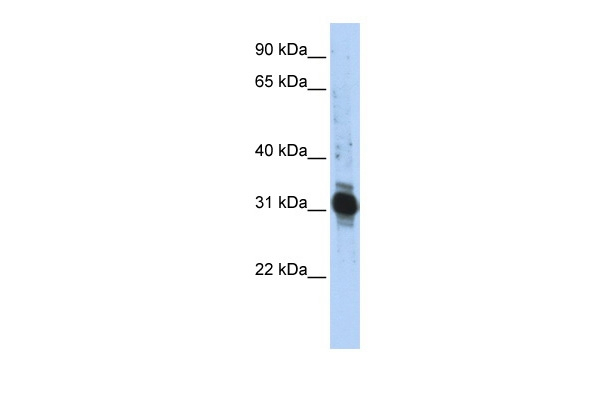 ZFAND3 Antibody in Western Blot (WB)