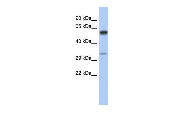 ZDHHC24 Antibody in Western Blot (WB)