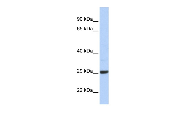 ZCCHC24 Antibody in Western Blot (WB)