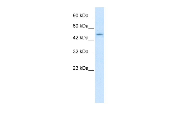 ZBTB47 Antibody in Western Blot (WB)