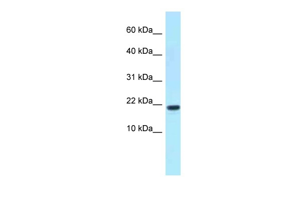 XAGE1D Antibody in Western Blot (WB)