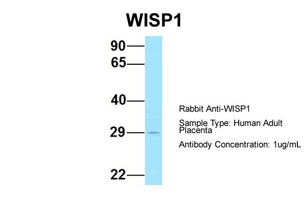 WISP1 Antibody in Western Blot (WB)