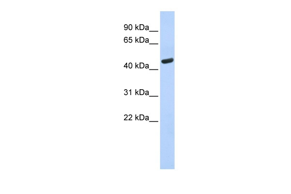 WARS Antibody in Western Blot (WB)