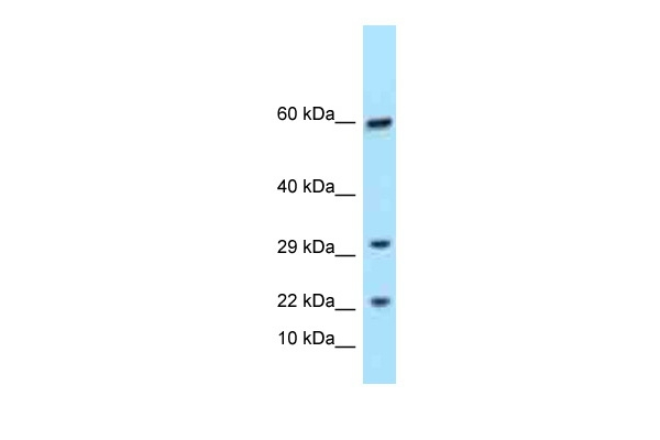 TRGC1 Antibody in Western Blot (WB)