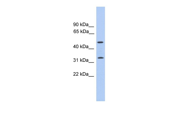 TPRG1 Antibody in Western Blot (WB)