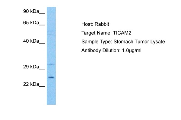 TMED7/TICAM2 Antibody in Western Blot (WB)