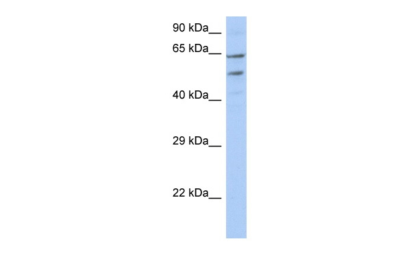 TMCC3 Antibody in Western Blot (WB)