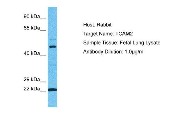TICAM2 Antibody in Western Blot (WB)