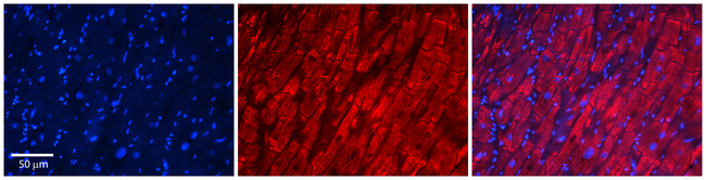 ST5 Antibody in Immunohistochemistry (Paraffin) (IHC (P))