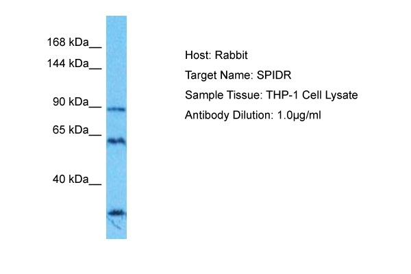 SPIDR Antibody in Western Blot (WB)