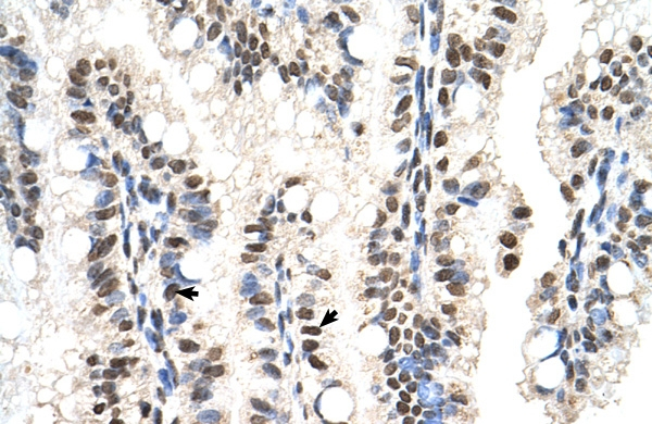 SNX29 Antibody in Immunohistochemistry (IHC)