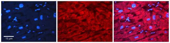 SMC1 Antibody in Immunohistochemistry (Paraffin) (IHC (P))
