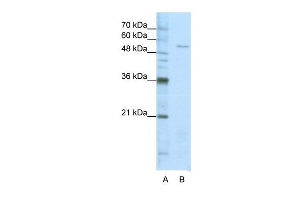 Seryl-tRNA synthetase Antibody in Western Blot (WB)