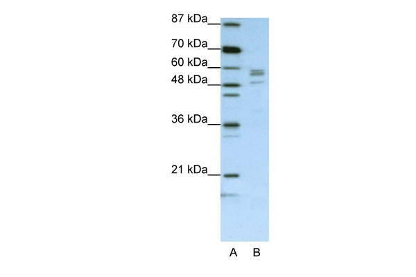Seryl-tRNA synthetase Antibody in Western Blot (WB)