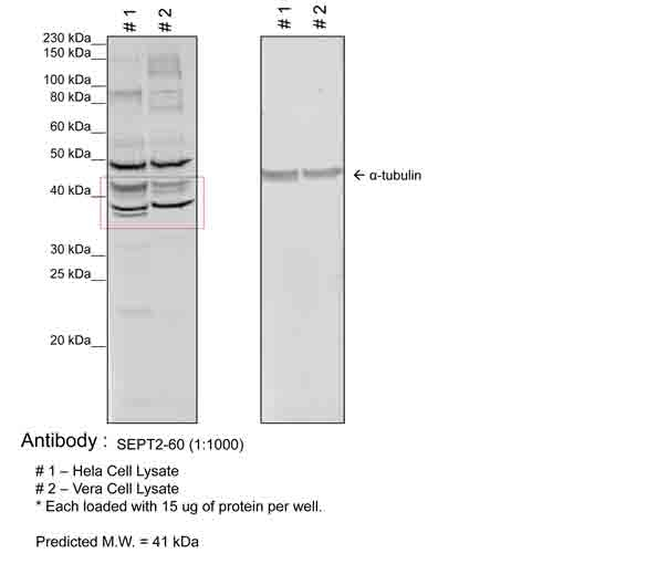 Septin 2 Antibody in Western Blot (WB)