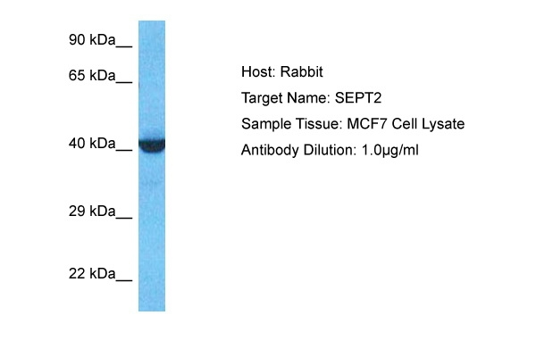Septin 2 Antibody in Western Blot (WB)