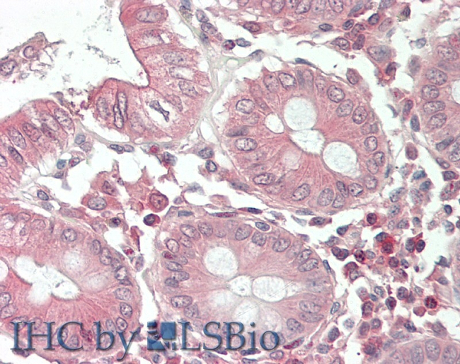 RNF213 Antibody in Immunohistochemistry (Paraffin) (IHC (P))