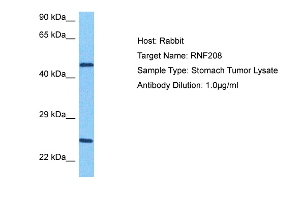 RNF208 Antibody in Western Blot (WB)