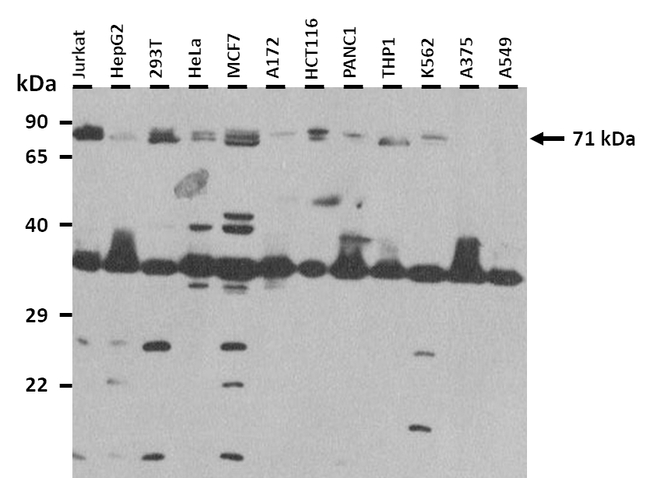 RNF207 Antibody in Western Blot (WB)