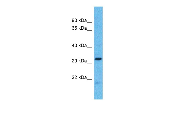 PTPRT Antibody in Western Blot (WB)