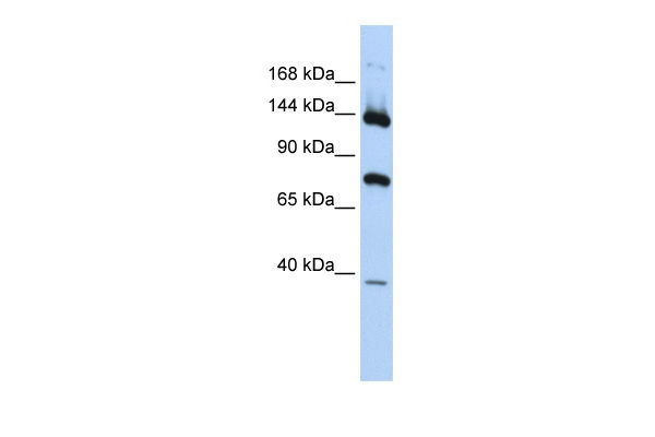 PLA2G4B Antibody in Western Blot (WB)