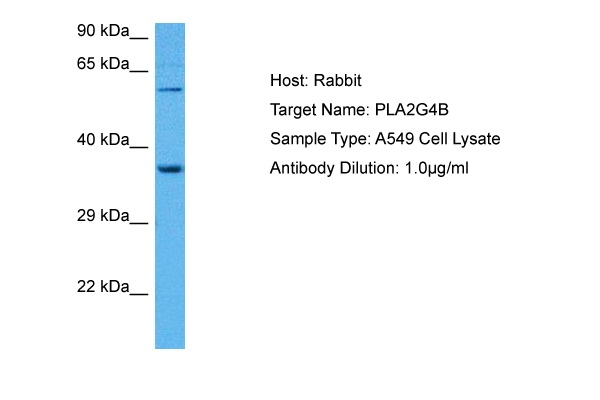 PLA2G4B Antibody in Western Blot (WB)