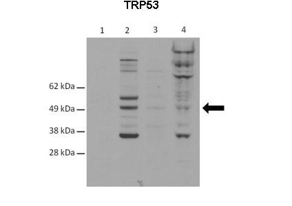p53 Antibody in Western Blot (WB)
