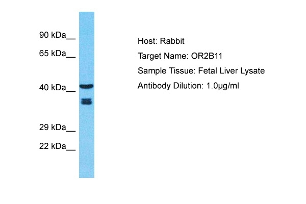 OR2B11 Antibody in Western Blot (WB)