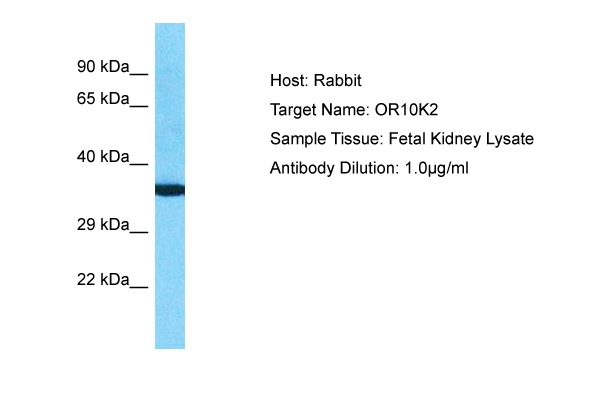 OR10K1/OR10K2 Antibody in Western Blot (WB)