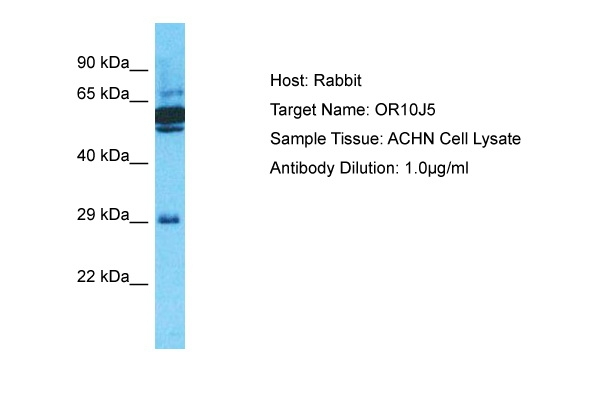 OR10J5 Antibody in Western Blot (WB)