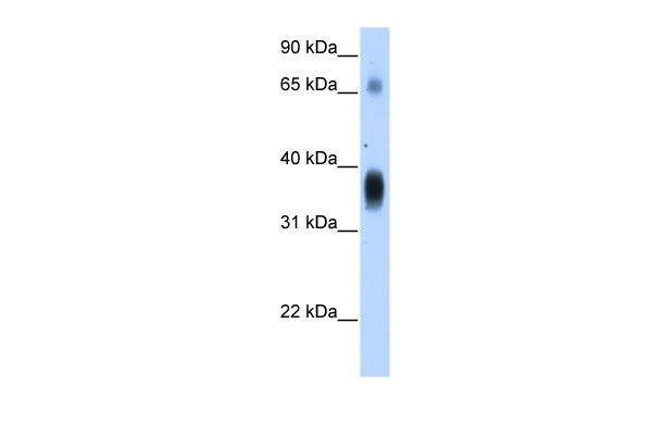 NOV Antibody in Western Blot (WB)
