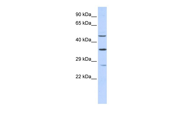 MEF2B Antibody in Western Blot (WB)