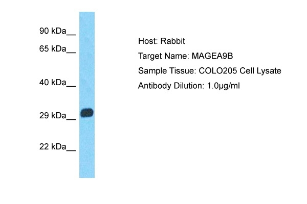 MAGEA9B Antibody in Western Blot (WB)